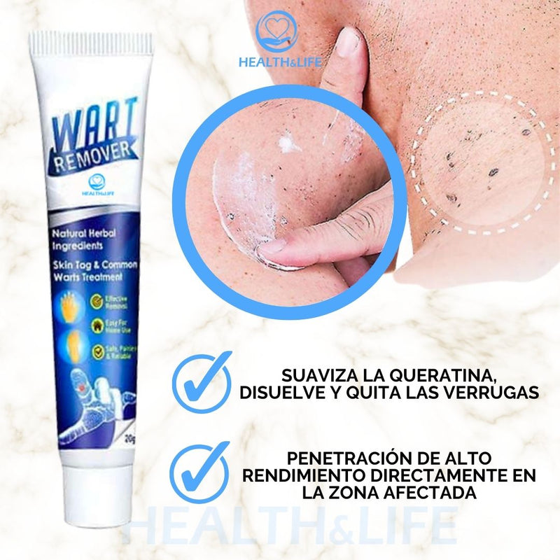 WartRemover™- Crema para la eliminación inmediata de las impurezas de la piel