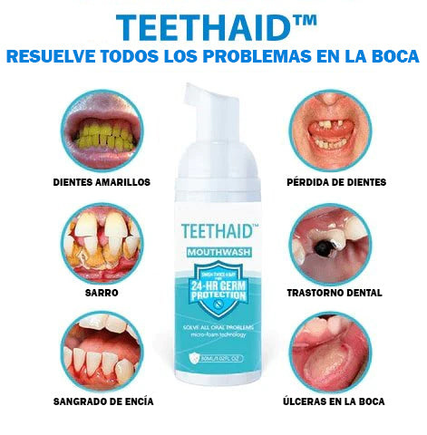 Teethaid™ Enjuage Reparador Bucal| 1+1 GRATIS
